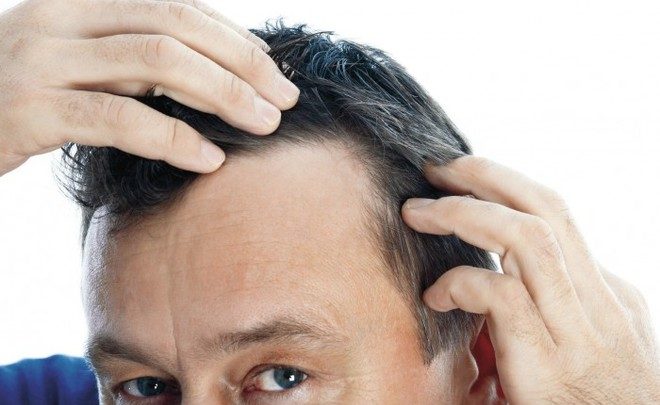 Come scegliere i trattamenti anticaduta dei capelli: consigli utili
